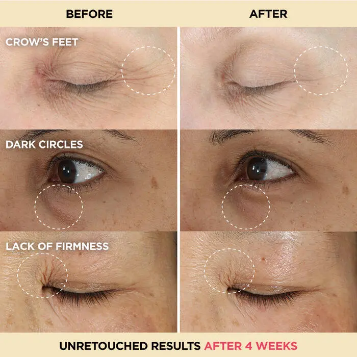 Before_After_DMI_940X940_V4-060622.webp