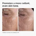 ord-glycolic-before-after-radiance.webp