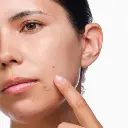 rdn-the-acne-set-application.webp
